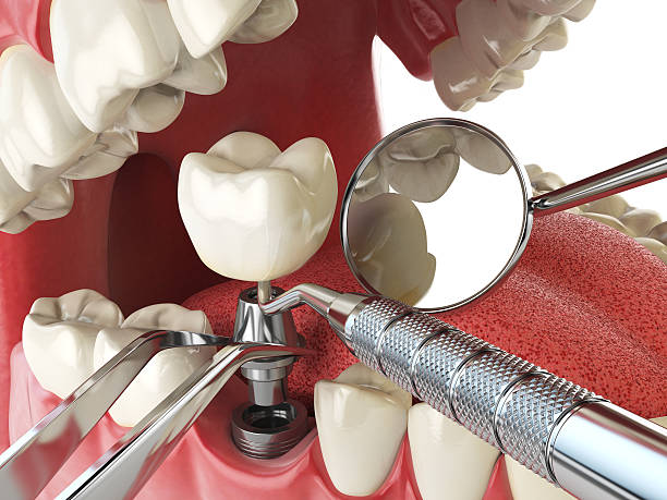 Best Emergency Dental Surgery in Enoch, UT